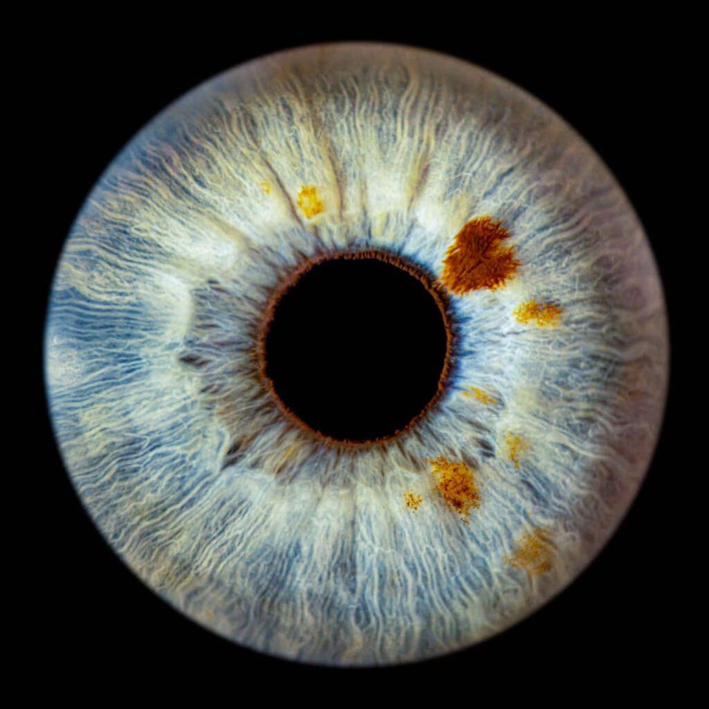 Iris-Blue-with-brown-spots